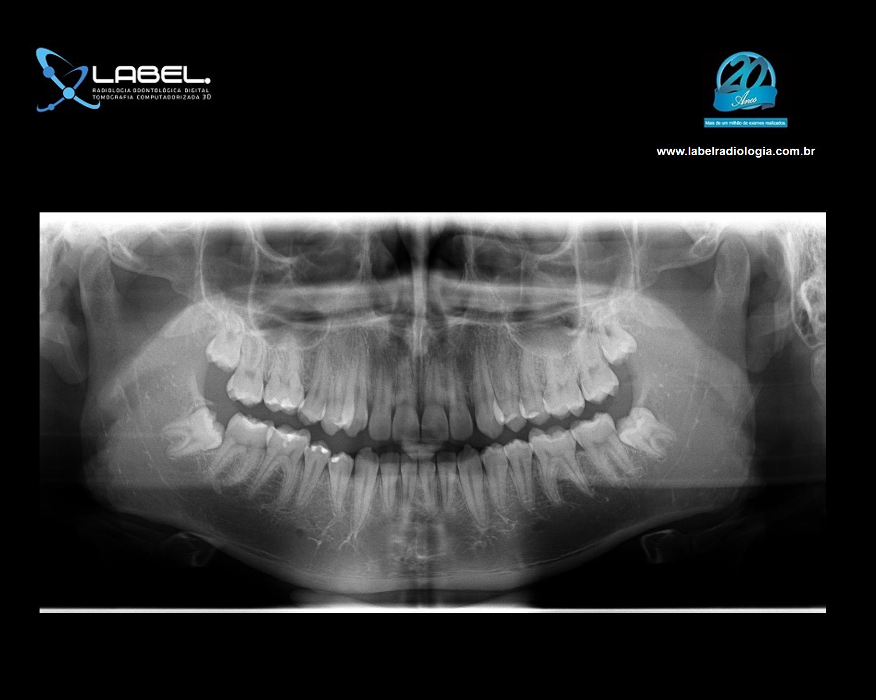Radiografia
